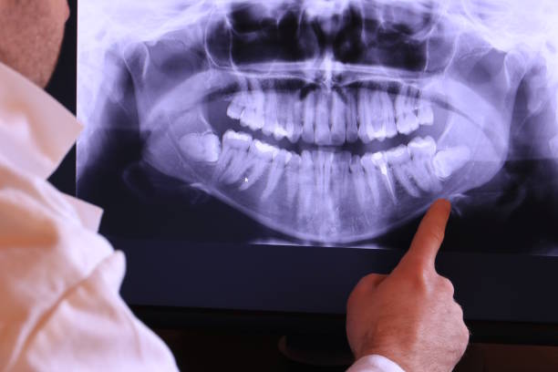 Best Emergency Treatment for Toothache in Moss Bluff, LA