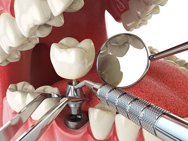 Best Emergency Orthodontic Repairs in Moss Bluff, LA